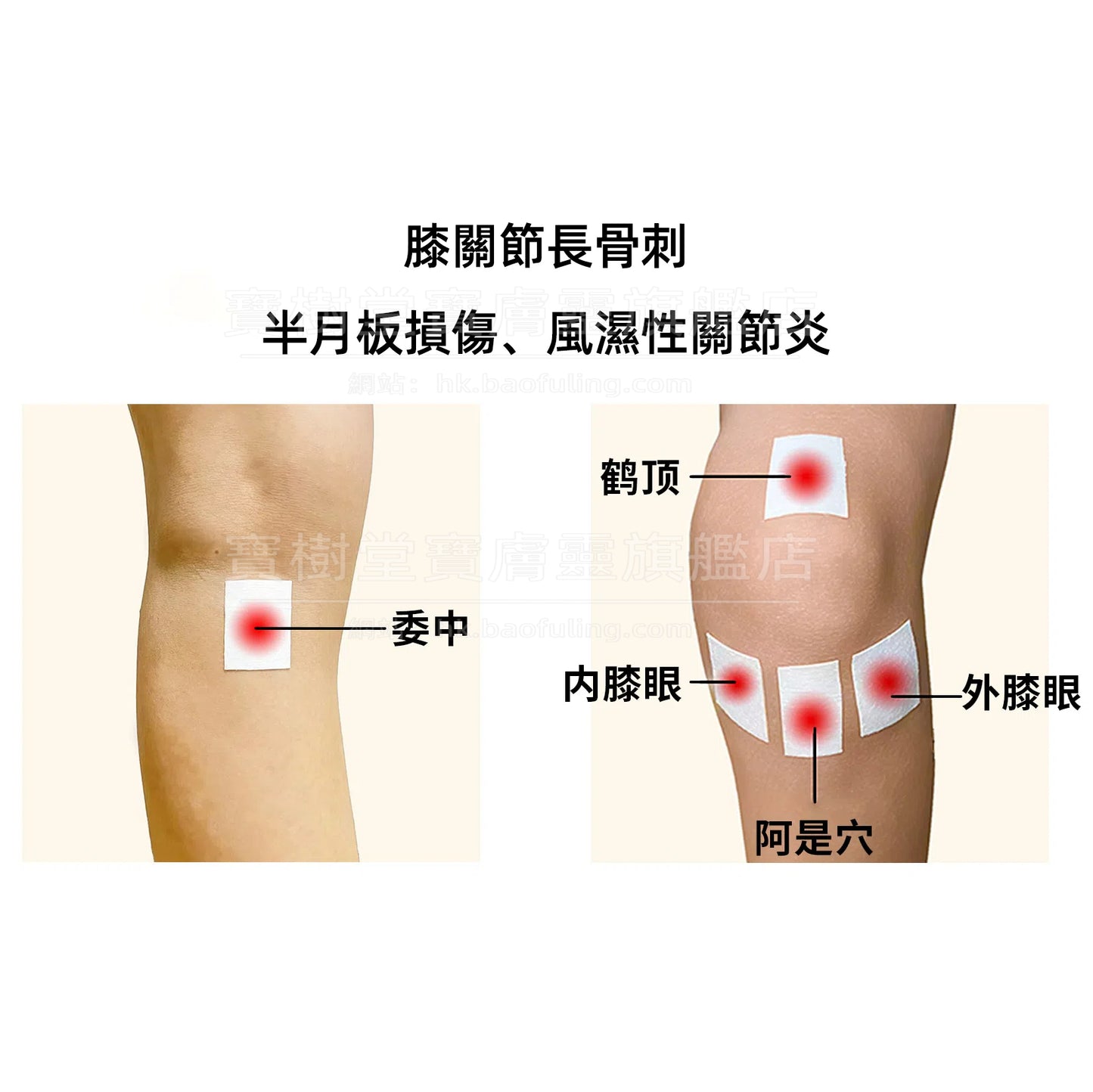 活血止痛套装(活血通络+镇痛消炎+消肿止痛)