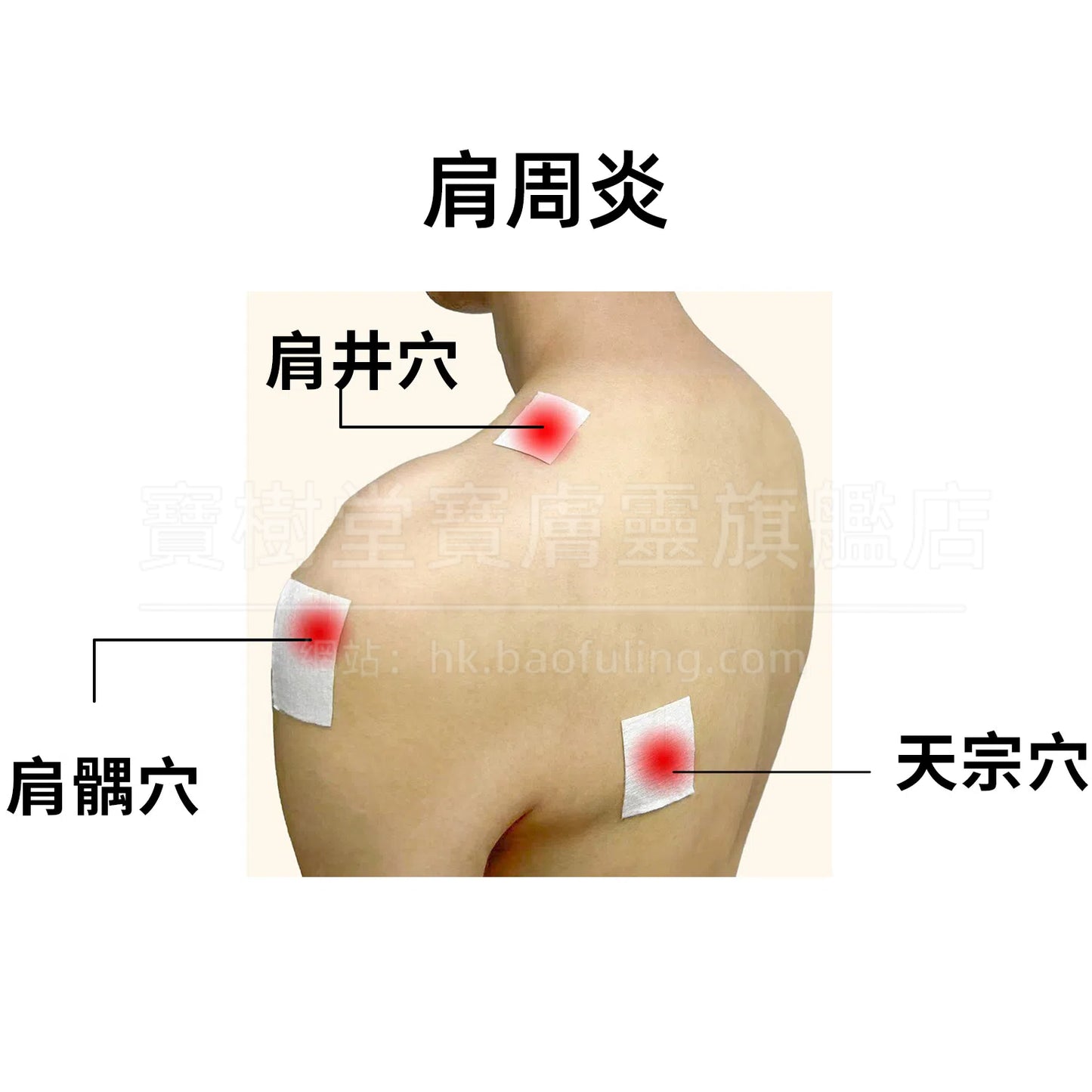 活血止痛套装(活血通络+镇痛消炎+消肿止痛)