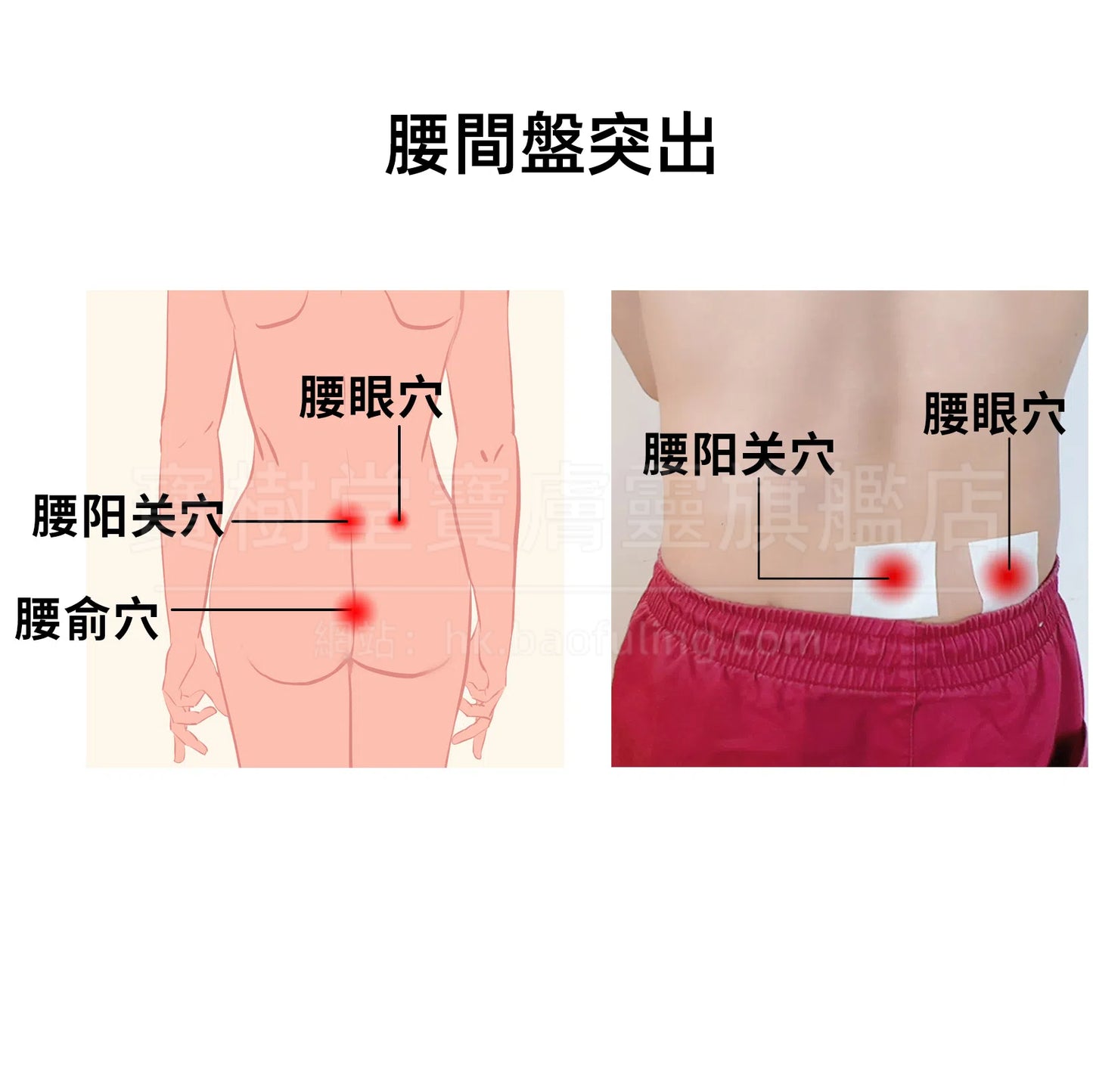 活血止痛套装(活血通络+镇痛消炎+消肿止痛)
