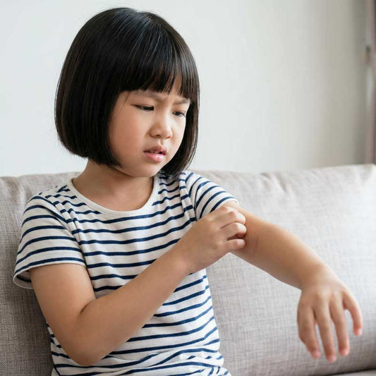 兒童濕疹、蚊爛點算好，可用類固醇嗎？一文詳解無類固醇藥膏嘅選擇指南